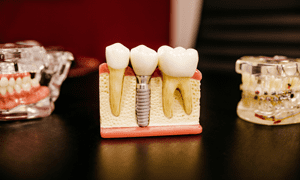 مقاله رشته دندانپزشکی