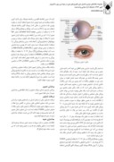 دانلود مقاله تشخیص هویت براساس عنبیه چشم با استفاده ازتبدیل موجک و SVM صفحه 2 