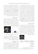 دانلود مقاله شناسایی تودههای کبدی در تصاویر CT اسکن با استفاده از شبکه عصبی SOM صفحه 2 
