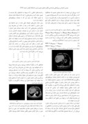 دانلود مقاله شناسایی تودههای کبدی در تصاویر CT اسکن با استفاده از شبکه عصبی SOM صفحه 3 