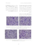 دانلود مقاله بررسی اثر مشتقات پکتینی در القای مرگ برنامه ریزی شده یا آپوپتوز در دودمان سلولی سرطان پروستات انسانی DU145 صفحه 4 