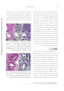 مقاله مارکر PS٥٠٤ در تشخیص پرولیفراسیون غددی آتیپیک پروستات صفحه 3 