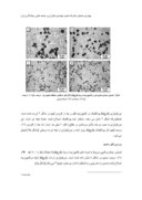 مقاله بررسی اثر Li و Na بر ریزساختار مقاطع نازک کامپوزیت درجا Al - Mg2Si صفحه 5 