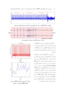 مقاله پیش بینی مرگ ناگهانی قلبی ( SCD ) با استفاده از تحلیل های زمان – فرکانس سیگنال الکتروکاردیوگرام صفحه 4 