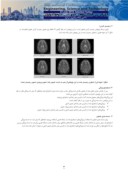 مقاله تشخیص بیماری MS با استفاده از پردازش تصاویر پزشکی صفحه 3 