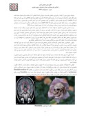 مقاله اصول و معیارهای طراحی فضاهای معماری بر مبنای یافته های علوم مغز و اعصاب صفحه 3 