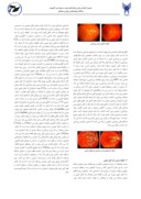مقاله استفاده از روش قطعه بندی تصویر برای آشکار سازی رگ های خونی تصویر شبکیه چشم با استفاده از فیلتر گابور صفحه 3 