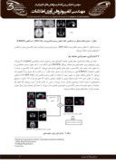 مقاله معرفی روش جدید تطبیق برای اندازه گیری دقیق تغییرات حجمی در تصاویر تشدید مغناطیسی مغزی بیماران مبتلا به اتیسم صفحه 3 