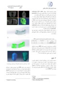 مقاله تحلیل اثر تغییر هندسه ایمپلنت بر بیومکانیک استخوان فک صفحه 3 