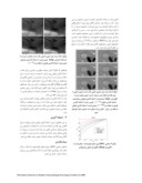 مقاله کاهش نویز لکه ای در تصاویر سه بعدی اولتراسوند در فضای ویولت . صفحه 5 