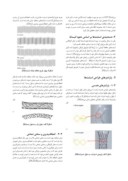 مقاله مروری برپارامترهای مکانیکی موثر در طراحی بهینه استنت صفحه 2 