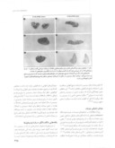 مقاله پاتوفیزیولوژی و درمان سپسیس صفحه 5 