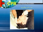 دانلود پاورپوینت آموزش CPR صفحه 13 