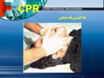 دانلود پاورپوینت آموزش CPR صفحه 15 
