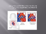 دانلود فایل پاورپوینت بیماری فیزیولوژی قلبی صفحه 12 