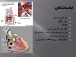دانلود فایل پاورپوینت بیماری فیزیولوژی قلبی صفحه 5 