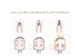 دانلود فایل پاورپوینت پوسیدگی دندان و علت آن صفحه 11 