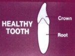 دانلود فایل پاورپوینت مفاهیم بهداشت دهان و دندان صفحه 4 