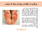 دانلود فایل پاورپوینت چگونه بیماری قند روی پاها اثر می گذارد؟ صفحه 4 