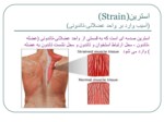 دانلود فایل پاورپوینت آسیب شناسی ورزشی 26 صفحه صفحه 8 