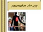 دانلود فایل پاورپوینت پیس میکر pacemaker صفحه 2 
