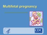 دانلود فایل پاورپوینت Multifetal pregnancy صفحه 1 