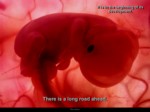 دانلود فایل پاورپوینت In the womb صفحه 3 