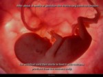 دانلود فایل پاورپوینت In the womb صفحه 6 