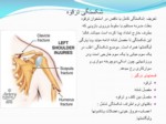 دانلود فایل پاورپوینت آسیب های شانه صفحه 5 