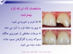 دانلود فایل پاورپوینت بهداشت دهان و دندان صفحه 11 