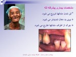 دانلود فایل پاورپوینت بهداشت دهان و دندان صفحه 12 