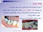 دانلود فایل پاورپوینت بهداشت دهان و دندان صفحه 6 
