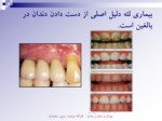 دانلود فایل پاورپوینت بهداشت دهان و دندان صفحه 7 
