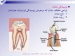 دانلود فایل پاورپوینت بهداشت دهان و دندان صفحه 9 