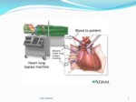دانلود فایل پاورپوینت جراحی قلب cardiac surjery صفحه 3 