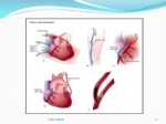 دانلود فایل پاورپوینت جراحی قلب cardiac surjery صفحه 6 