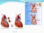 دانلود فایل پاورپوینت جراحی قلب cardiac surjery صفحه 8 