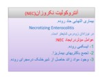 دانلود فایل پاورپوینت آنتروکولیت نکروزان ( NEC ) صفحه 2 