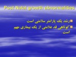 دانلود فایل پاورپوینت Post Natal Growth Abnormalities صفحه 3 