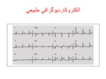 دانلود فایل پاورپوینت الکتروکاردیوگرام صفحه 15 