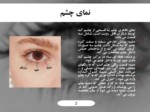 دانلود فایل پاورپوینت آناتومی چشم انسان صفحه 3 