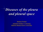 دانلود فایل پاورپوینت Diseases of the pleura and pleural space صفحه 1 