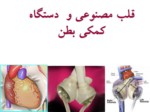 دانلود فایل پاورپوینت قلب مصنوعی و دستگاه کمکی بطن صفحه 1 