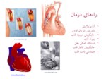 دانلود فایل پاورپوینت قلب مصنوعی و دستگاه کمکی بطن صفحه 3 