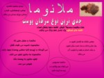 دانلود فایل پاورپوینت سرطان صفحه 4 