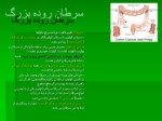 دانلود فایل پاورپوینت سرطان صفحه 6 