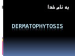 دانلود فایل پاورپوینت Dermatophytosis صفحه 1 