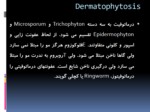 دانلود فایل پاورپوینت Dermatophytosis صفحه 2 