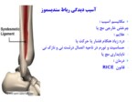 دانلود فایل پاورپوینت آسیب های مچ پا و پا صفحه 14 