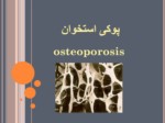 دانلود فایل پاورپوینت پوکی استخوان osteoporosis صفحه 1 